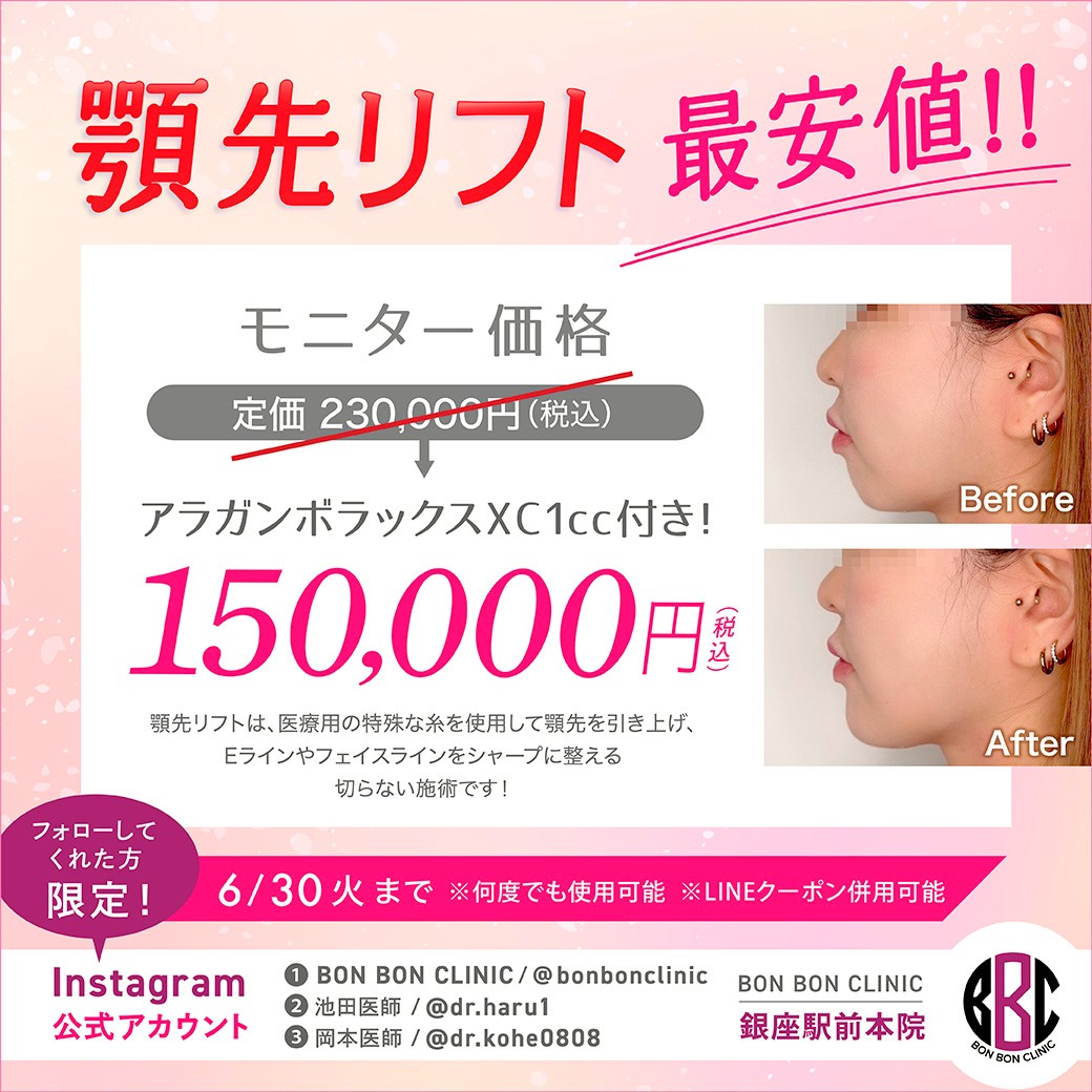 顎先リフトのクーポン画像
