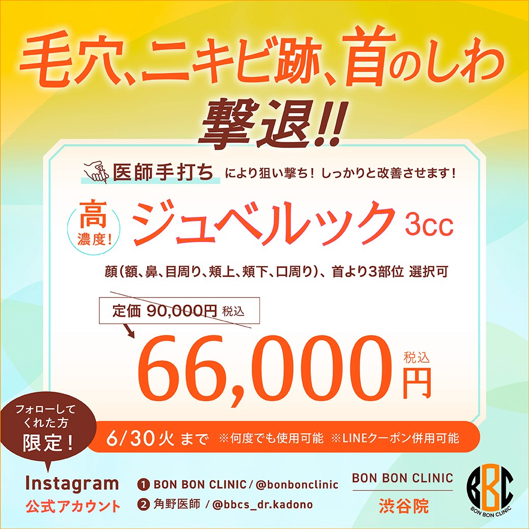 ジュベルックのクーポン画像